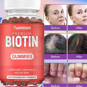 Complément alimentaire pour la croissance des cheveux ASAP OEM, nid d'oiseau, biotine 500 mg, gommes pour adultes, vitamines pour les cheveux, la peau et les ongles - Product Image 2