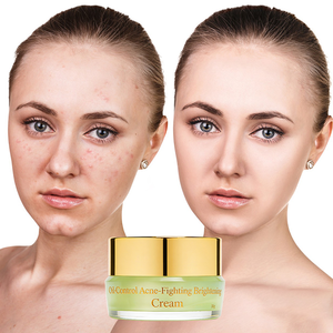 Crème Réparatrice Anti-Acné et Anti-Imperfections pour le Visage avec Extrait d'Arbre à Thé et de Centella Asiatica, Contrôle du Sébum et <span class=keywords><strong>Acide</strong></span> Salicylique - Product Image 4