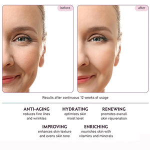 OEM Private Label <span class=keywords><strong>Meilleure</strong></span> <span class=keywords><strong>Crème</strong></span> Anti-âge Hydratante au Rétinol <span class=keywords><strong>et</strong></span> au <span class=keywords><strong>Collagène</strong></span> pour le Visage <span class=keywords><strong>et</strong></span> les Yeux-Avec <span class=keywords><strong>Acide</strong></span> <span class=keywords><strong>Hyaluronique</strong></span> - Product Image 4