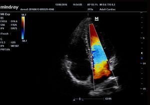 Máquina de ultrasonido <span class=keywords><strong>Doppler</strong></span> a <span class=keywords><strong>color</strong></span> digital completo portátil Mindray M6 M55 con calidad perfecta - Product Image 4