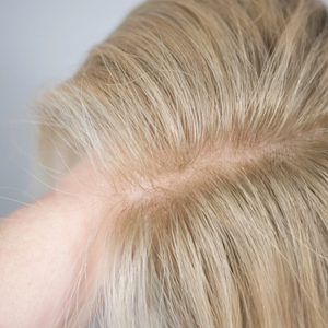 شعر مستعار أوروبي ريمي عذراء، قطعة علوية كبيرة الحجم 10x10 بدانتيل أمامي، قطع شعر علوية من شعر بشري طبيعي كامل الكثافة للنساء - Product Image 2