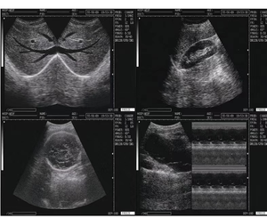 Dispositivo portátil médico do ultrassom de alta definição de Doppler, varredor de capacidade elevada do ultrassom do corpo humano do Portátil-tipo - Product Image 3