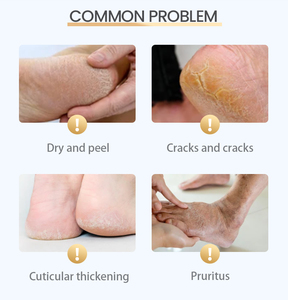 Masque exfoliant pour les pieds vegan à l'<span class=keywords><strong>aloe</strong></span> <span class=keywords><strong>vera</strong></span>, marque privée d'usine, pour peaux sensibles, soin spa - Product Image 5