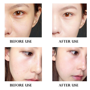 Lifitt Vitamin C Hautpflege Serum Gesicht feuchtigkeit spendende dunkle Knöchel entfernen Glutathion aufhellen des Serum - Product Image 4