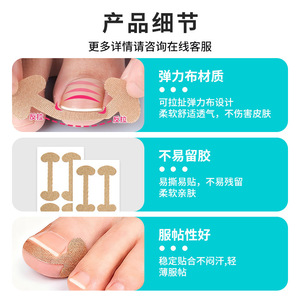 สติ๊กเกอร์แก้ไขเล็บแบบกำหนดเอง, ตัวแก้ไขเล็บขบ, สติ๊กเกอร์แก้ไขเล็บแบบไม่ใช้กาว, สติ๊กเกอร์จัดเรียงฟัน, สติ๊กเกอร์แก้ไขเล็บขบ - Product Image 3