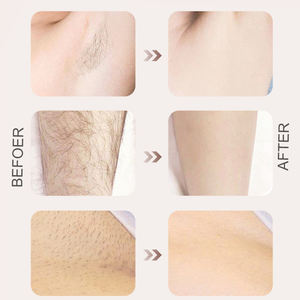 Электрическая Машинка для удаления волос - Product Image 6