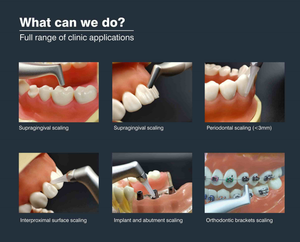 Dispositivo di Lucidatura Dentale Airjet 1S con Sabbiatura per Profilassi Clinica con Fonte di Alimentazione a Turbina Elettrica - Product Image 4