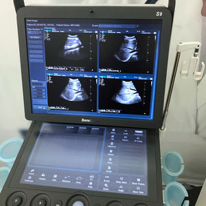 Draagbare 3D 4D Kleur Doppler Usg & Sonoscape S9 - Product Image 6