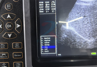 Appareil d'échographie vétérinaire entièrement numérique portable, scanner de diagnostic ultrasonore portatif pour l'examen clinique des animaux