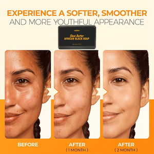 <span class=keywords><strong>Savon</strong></span> noir africain Luxfume avec beurre de karité, nourrit et adoucit la <span class=keywords><strong>peau</strong></span>, nettoie en profondeur les pores, contrô<span class=keywords><strong>le</strong></span> <span class=keywords><strong>le</strong></span> sébum, végétalien - Product Image 2