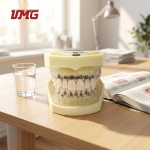 Modelo de Enfermedad Periodontal con Encía Transparente que Demuestra la Recesión Gingival para la Educación del Paciente en Clínicas Dentales - Product Image 1