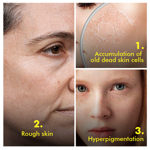 <span class=keywords><strong>Bodylife</strong></span> Bio Kurkuma Gesicht Aufhellung nährt Peeling Kurkuma Vitamin C Niacin amid Peeling Gesichts peeling - Product Image 5