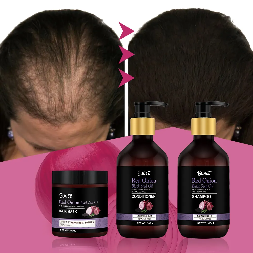 300ml Bunee organic healthy scalp BIOTIN Booster Thicker RedOnion hair growth shampoo and conditioner