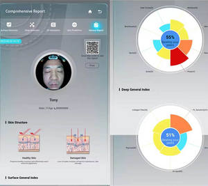 Machine Visia de diagnostic de la santé cutanée par détection 3D, modèle 2025, la plus vendue, pour l'analyse du visage, 13,3 pouces et 21 pouces - Product Image 3