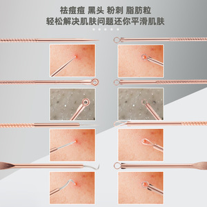 Stainless Steel Acne Needle 4 Piece Set Double-Ended Blackhead <b>Remover</b> Facial Beauty Tool For Face Care - Product Image 1