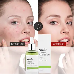 Korean Cosmetics Best Organic Facial Skin care Tea Tree Oil Face Clear Serum Anti Acne Pimple Remover Herbal Treatment