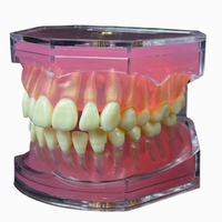 Modèle d'entraînement à l'extraction dentaire, dents détachables avec gencives en silicone souple
