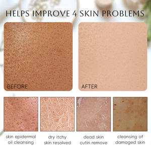 Logo et Emballage Personnalisés pour Gants de Douche Exfoliants Gants Exfoliants Marocains - Product Image 5