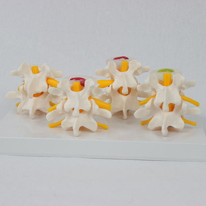 Modelo de degeneración de vértebras lumbares de 4 etapas de ciencia médica modelo de columna vertebral humana modelo de disco intervertebral Lumbar - Product Image 2