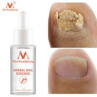 Essence pour ongles à base de plantes 30 ml, répare les ongles abîmés, adoucit les cuticules, favorise la croissance et restaure la santé des ongles