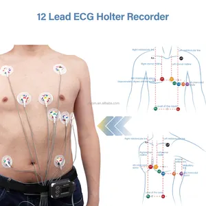 Viatom Th12แบบพกพาเครื่องตรวจจับคลื่นไฟฟ้าหัวใจ24ชั่วโมง, เครื่องวัดอัตราการเต้นของหัวใจแบบไดนามิกเครื่อง ECG 12ช่องสัญญาณ