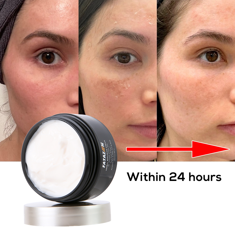 Private Label Hydrating Moisturizing Whitening Freckle