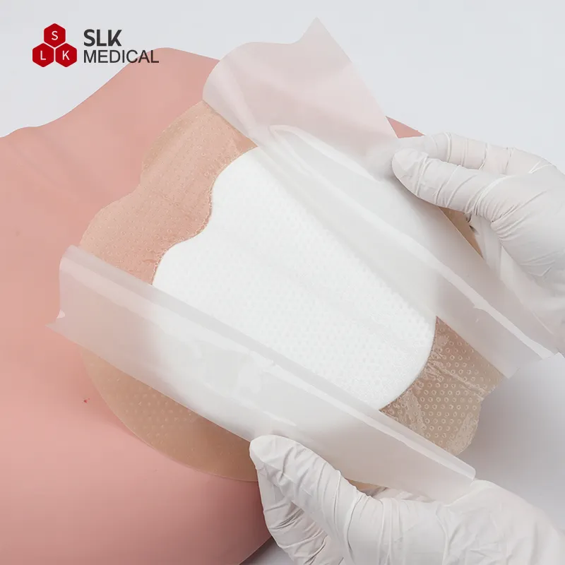 Alexer Foam Dressing Medical Grade Silicone Adhesive Border Sacrum Silicone Foam Dressing for Pressure Ulcer
