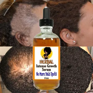 New Arrival Smoothing Repairing Anti Loss Hair Oil Regrowth Scalp Elixirs Private Label Hair Growth Oil Serum