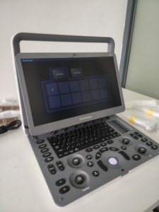 Ecógrafo Doppler Color Portátil Sonoscape E2 con Imagen Panorámica para Exámenes Cardíacos y de Emergencia POC - Product Image 6
