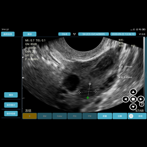 Grado impermeabile ad alta risoluzione elemento 128 convesso sonda MSLMY12 senza fili di colore Doppler ultrasuoni per clinica medica - Product Image 6