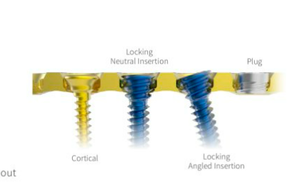 Vis corticale orthopédique pour fracture osseuse canine RUNPHY, en alliage de titane autotaraudeur, 1.1/2.0/2.4/2.7/3.5mm, MINI - Product Image 4