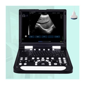<span class=keywords><strong>Ultra</strong></span>-som Sistema diagnóstico Sonoscape Ultrasound Máquina Equipamento Equipamento médico Máquina - Product Image 1