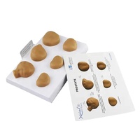 Modèle anatomique de la prostate masculine examen médical modèle d'exercice de palpation modèle de comparaison de pathologie de la prostate