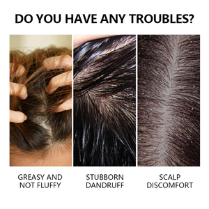 Aceite de Coco OEM <span class=keywords><strong>para</strong></span> <span class=keywords><strong>el</strong></span> Tratamiento del <span class=keywords><strong>Cabello</strong></span> y Cuero Cabelludo - Anticaspa, Reparación del <span class=keywords><strong>Cabello</strong></span> Dañado y Nutritivo - Product Image 3