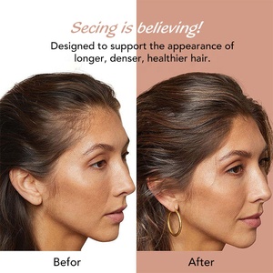 Sérum de croissance <span class=keywords><strong>des</strong></span> cheveux <span class=keywords><strong>des</strong></span> <span class=keywords><strong>sourcils</strong></span> Sérum de croissance <span class=keywords><strong>des</strong></span> cheveux pour femme personnalisé Sérum capillaire OEM - Product Image 4