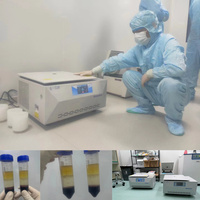 Centrifugeuse médicale portable réfrigérée à basse vitesse CE ISO 4-5R avec RCF 6321xg et moteur DC sans balais pour laboratoires cliniques