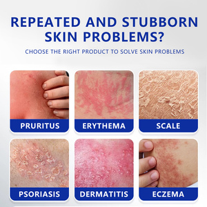 Гель и мазь от лишая, дерматита, экземы, укусов комаров, зуда - Product Image 3