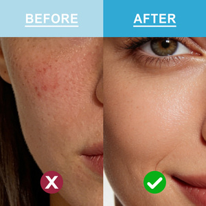 Üstün Çoklu Kolajen Süper Karışım Tozu, Cilt, Saç ve Eklem Sağlığı için Lipozomal C Vitamini ile Zenginleştirilmiş, GDO'suz, Yüksek Proteinli - Product Image 4