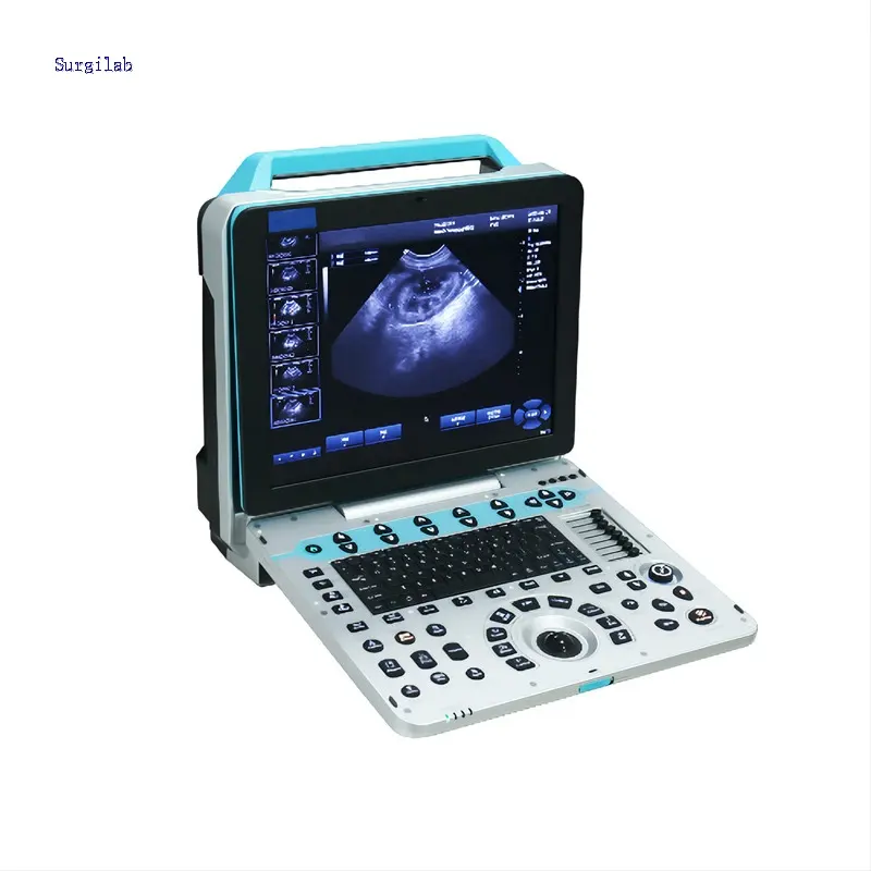 Macchina ad ultrasuoni conveniente per lavorare portatile/Laptop/attrezzatura medica ad ultrasuoni cina