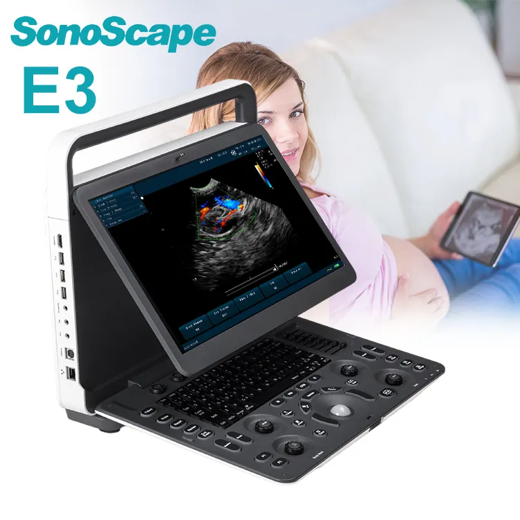 High End Merk Sonoscape E3 Kleur Doppler Ultrasound Machine, Sonoscape Kleur Doppler