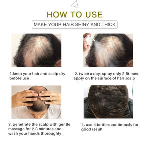 Alopecia Cure เซรั่มบำรุงผม,สมุนไพรออร์แกนิคช่วยให้ผมงอกใหม่ได้เร็วน้ำมันให้ความชุ่มชื้น - Product Image 6