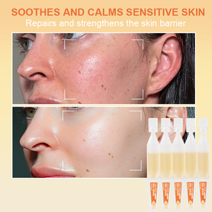 Suero Facial OEM Iluminador, Blanqueador, Suavizante, Rejuvenecedor, con Efecto Radiante, Anti-Manchas, Elasticidad, Desechable, de Un Solo Uso - Product Image 6