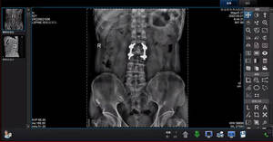 Detector de Panel Plano de Rayos X Médico, Sistema de Rayos X Digital Veterinario de Panel Plano, Detector de Panel Plano de Rayos X con Cable Cmos - Product Image 4