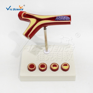 Modelo cardiovascular humano, modelo de trombosis patológica - Product Image 1