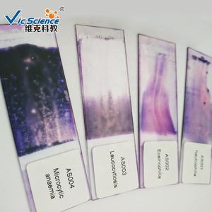 Microscoop Geprepareerde Glaasjes Hematologie Geprepareerde Dia 'S Met Bloeduitstrijkje - Product Image 2