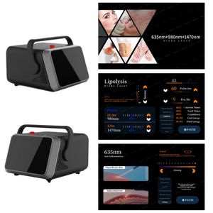 Láser de Diodo Portátil y Funcional de 1470, 980 y 635nm para Terapia de Várices, Lipólisis y Recuperación de Afecciones Cutáneas Crónicas - Product Image 4