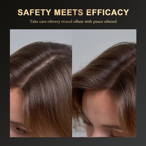 Nhà Máy OEM Bán Buôn Kiểm Soát Dầu Nuôi Dưỡng Tăng Cường Chống Rụng Tóc Nhân Sâm Tăng Trưởng Tóc Người Đàn Ông Phụ Nữ Gốc Activator Dầu Gội Đầu - Product Image 6