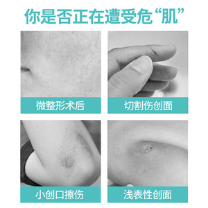 น้ำยาบำรุงผิวหน้าและสมานแผล น่านจิง ถงเหรินถัง เมดิคอล ไฮยาลูโรนิค แอซิด รีแพร์ โซลูชั่น ขนาด 30 มล. แบบสเปรย์ - Product Image 5