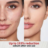 Sérum Visage Professionnel à l'Extrait de Riz AHA+BHA Acide Tranexamique Niacinamide Exfoliant Lissant Hydratant Éclaircissant