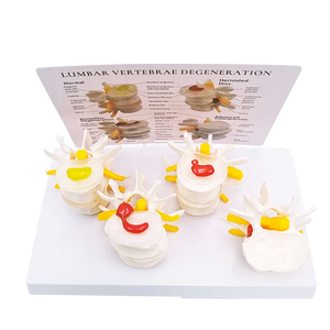 Tussenwervelschijf Degeneratie Osteoporose Model Lumbale Hernia Model Normale Plastic Lumbale Wervelkolom Model - Product Image 3